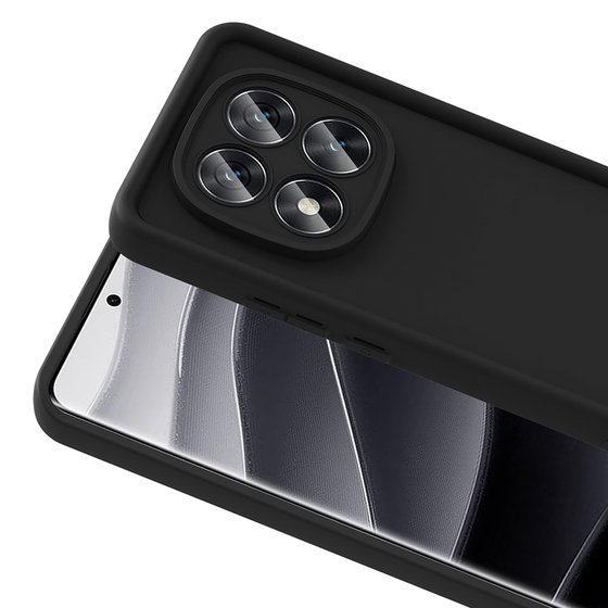 Redmi Note 14 Pro 5G Kılıf Kamera Korumalı Ananas Silikon Kapak