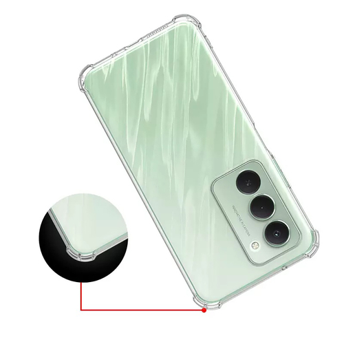 Redmi 15 Kılıf Köşeleri Airbagli Kamera Çıkıntılı Silikon