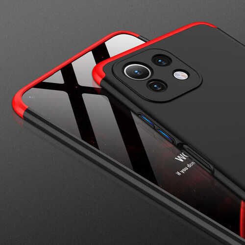 Xiaomi Mi 11 Lite Kılıf Zore Kamera Korumalı 360 Tam Koruma Ays