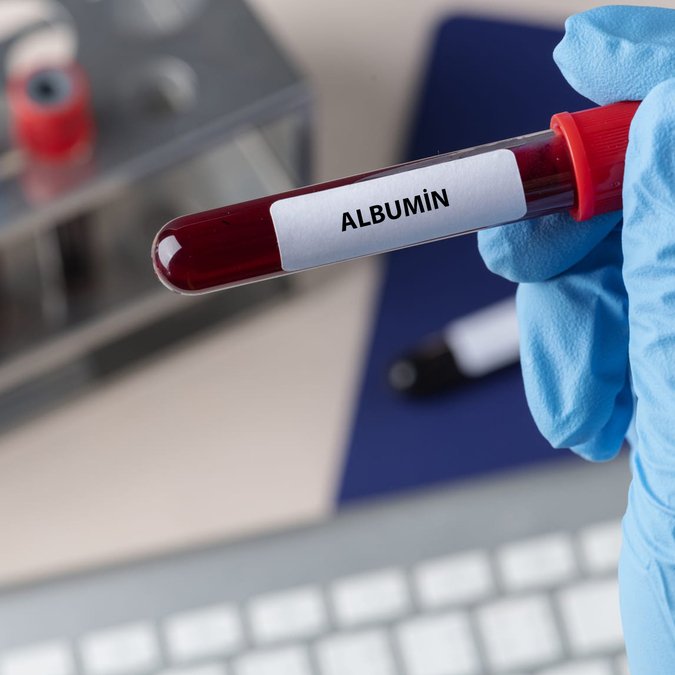 Albumin