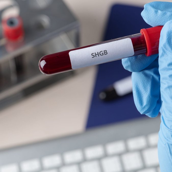 Seks Hormon Bağlayıcı Globülin (SHBG)