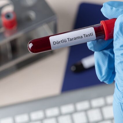 Dörtlü Tarama Testi