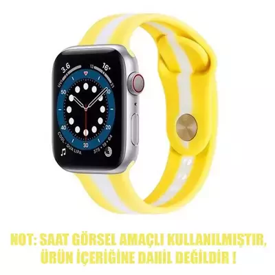 Microsonic Apple Watch Series 4 44mm Kordon Town Stripe Sarı