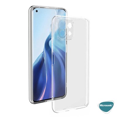 Microsonic Xiaomi Mi 11 Lite Kılıf Transparent Soft Beyaz