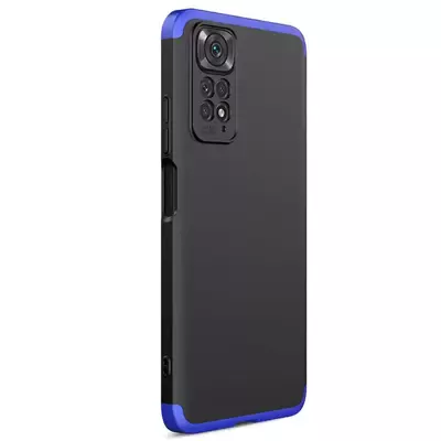 Microsonic Xiaomi Redmi Note 11 Pro 5G Kılıf Double Dip 360 Protective AYS Siyah Mavi