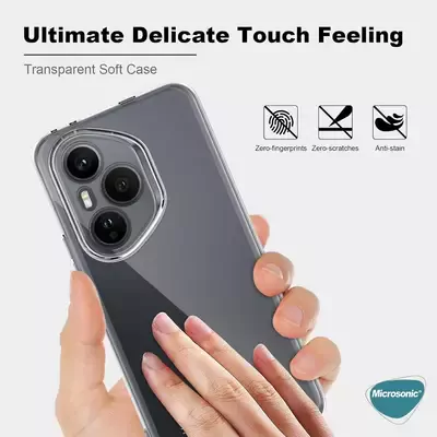 Microsonic Honor 400 Pro Kılıf Transparent Soft Şeffaf