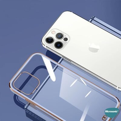 Microsonic Xiaomi Redmi Note 10S Kılıf Laser Plated Soft Lacivert