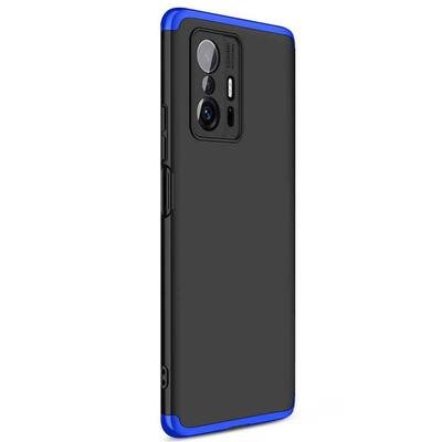 Microsonic Xiaomi Mi 11T Pro Kılıf Double Dip 360 Protective AYS Siyah Mavi