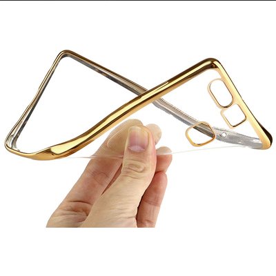 Microsonic Huawei P9 Kılıf Skyfall Transparent Clear Gold