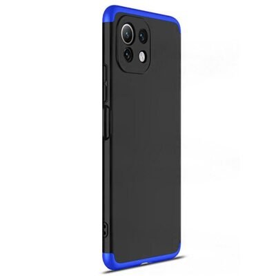 Microsonic Xiaomi Mi 11 Lite Kılıf Double Dip 360 Protective AYS Siyah Mavi