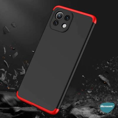 Microsonic Xiaomi Mi 11 Lite Kılıf Double Dip 360 Protective AYS Siyah Mavi