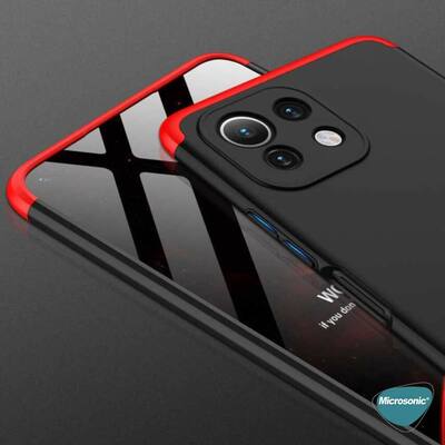 Microsonic Xiaomi Mi 11 Lite Kılıf Double Dip 360 Protective AYS Siyah Mavi