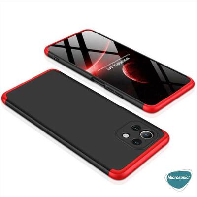 Microsonic Xiaomi Mi 11 Lite Kılıf Double Dip 360 Protective AYS Siyah Gri