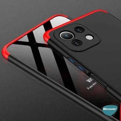 Microsonic Xiaomi Mi 11 Lite Kılıf Double Dip 360 Protective AYS Siyah Gri