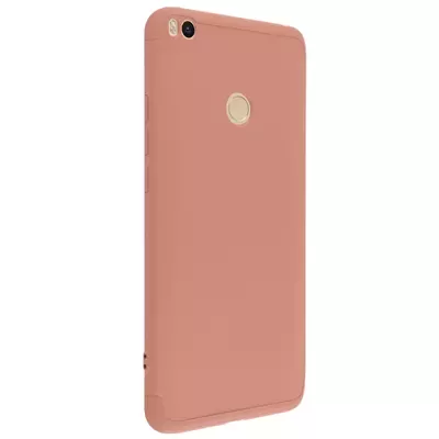 Microsonic Xiaomi Mi Max 2 Kılıf Double Dip 360 Protective Rose Gold