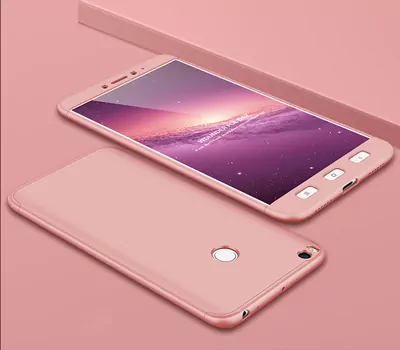 Microsonic Xiaomi Mi Max 2 Kılıf Double Dip 360 Protective Rose Gold