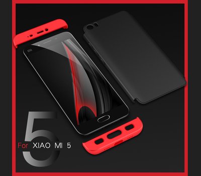 Microsonic Xiaomi Mi5 Prime Kılıf Double Dip 360 Protective AYS Lacivert