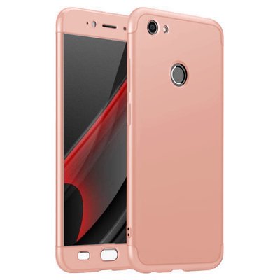 Microsonic Xiaomi Redmi Note 5A Prime Kılıf Double Dip 360 Protective AYS Rose Gold