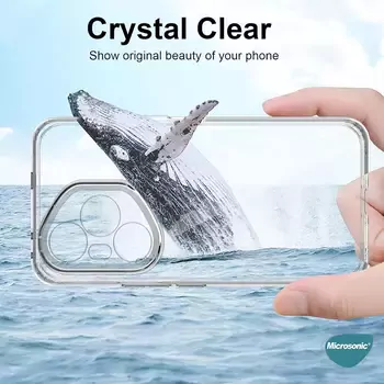 Microsonic Honor 400 Pro Kılıf Transparent Soft Şeffaf