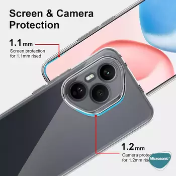 Microsonic Honor 400 Pro Kılıf Transparent Soft Şeffaf