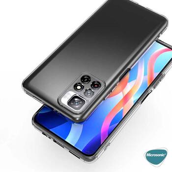 Microsonic Xiaomi Redmi Note 11 Kılıf Transparent Soft Beyaz