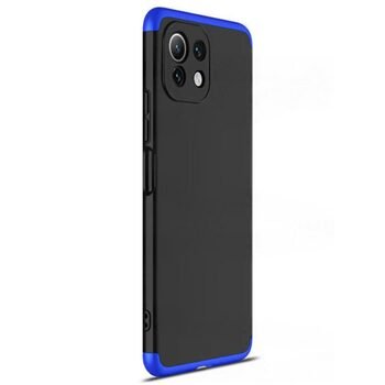 Microsonic Xiaomi Mi 11 Lite Kılıf Double Dip 360 Protective AYS Siyah Mavi