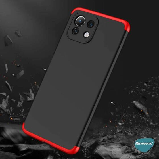 Microsonic Xiaomi Mi 11 Lite Kılıf Double Dip 360 Protective Siyah