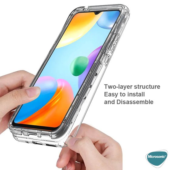 Microsonic Xiaomi 15 Kılıf 6 tarafı tam full koruma 360 Clear Soft Şeffaf