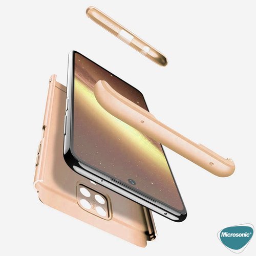 Microsonic Xiaomi Redmi Note 9 Pro Max Kılıf Double Dip 360 Protective Gold