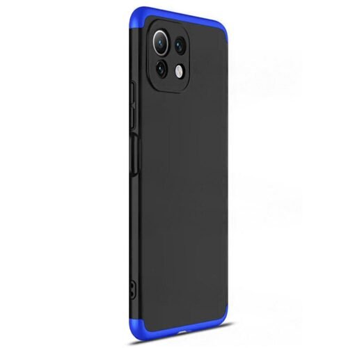 Microsonic Xiaomi Mi 11 Lite Kılıf Double Dip 360 Protective Siyah Mavi