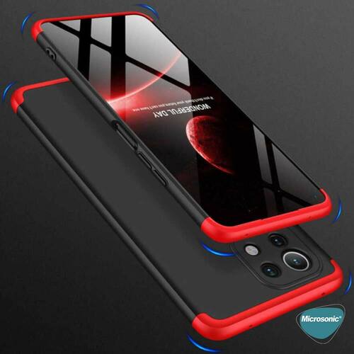 Microsonic Xiaomi Mi 11 Lite Kılıf Double Dip 360 Protective Siyah Mavi