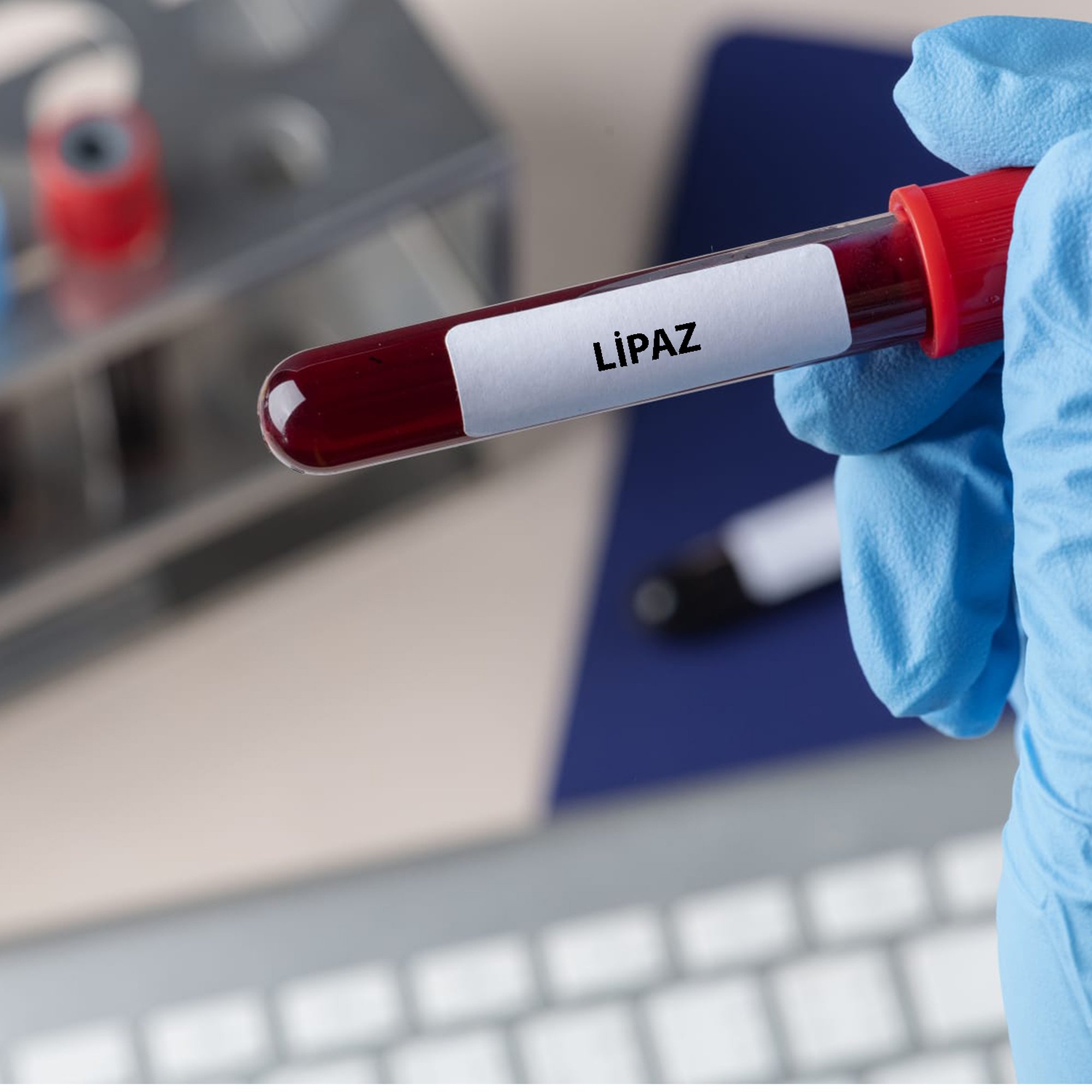 Lipase