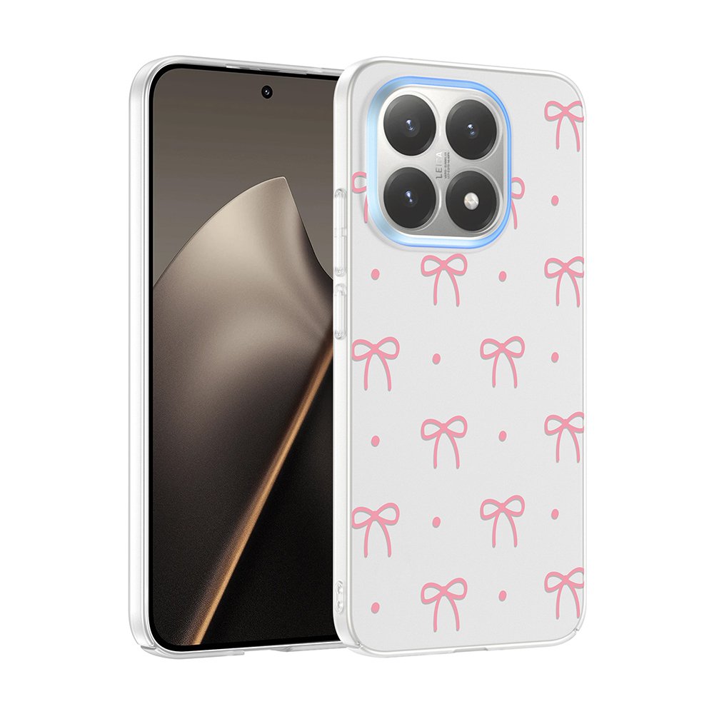 Xiaomi 15T Kılıf Kamera Korumalı Canlı Lüx Desenli Klip Sert Kapak