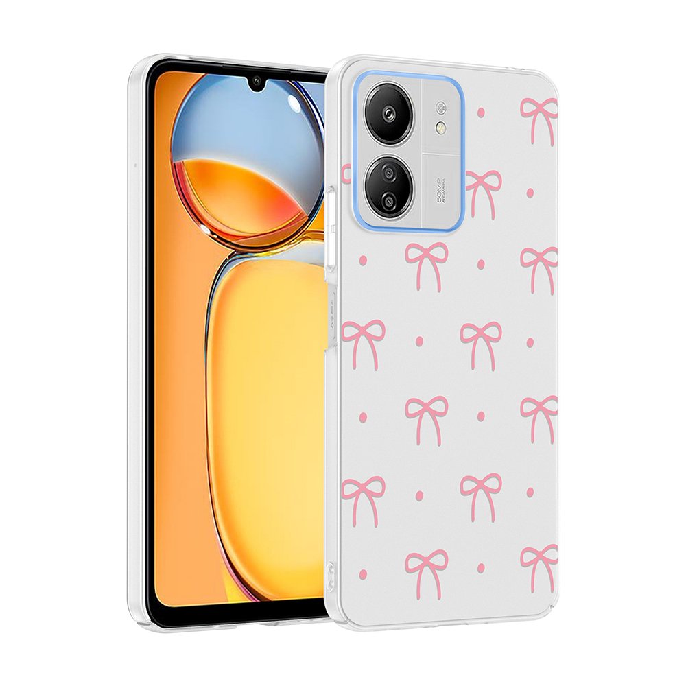Xiaomi Redmi 13C Kılıf Kamera Korumalı Canlı Lüx Desenli Klip Sert Kapak