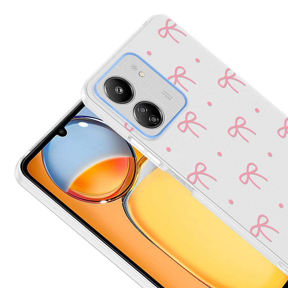Xiaomi Redmi 13C Kılıf Kamera Korumalı Canlı Lüx Desenli Klip Sert Kapak