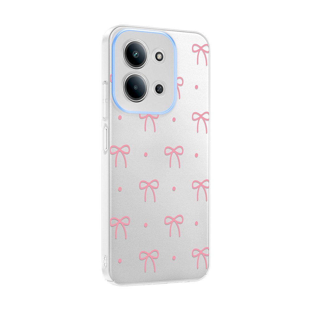 Xiaomi Redmi 15C Kılıf Kamera Korumalı Canlı Lüx Desenli Klip Sert Kapak