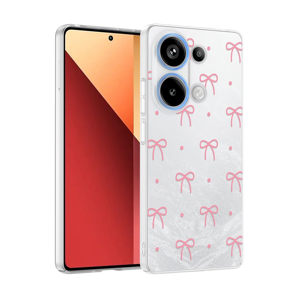 Xiaomi Redmi Note 13 Pro 4G Kılıf Kamera Korumalı Canlı Lüx Desenli Klip Sert Kapak