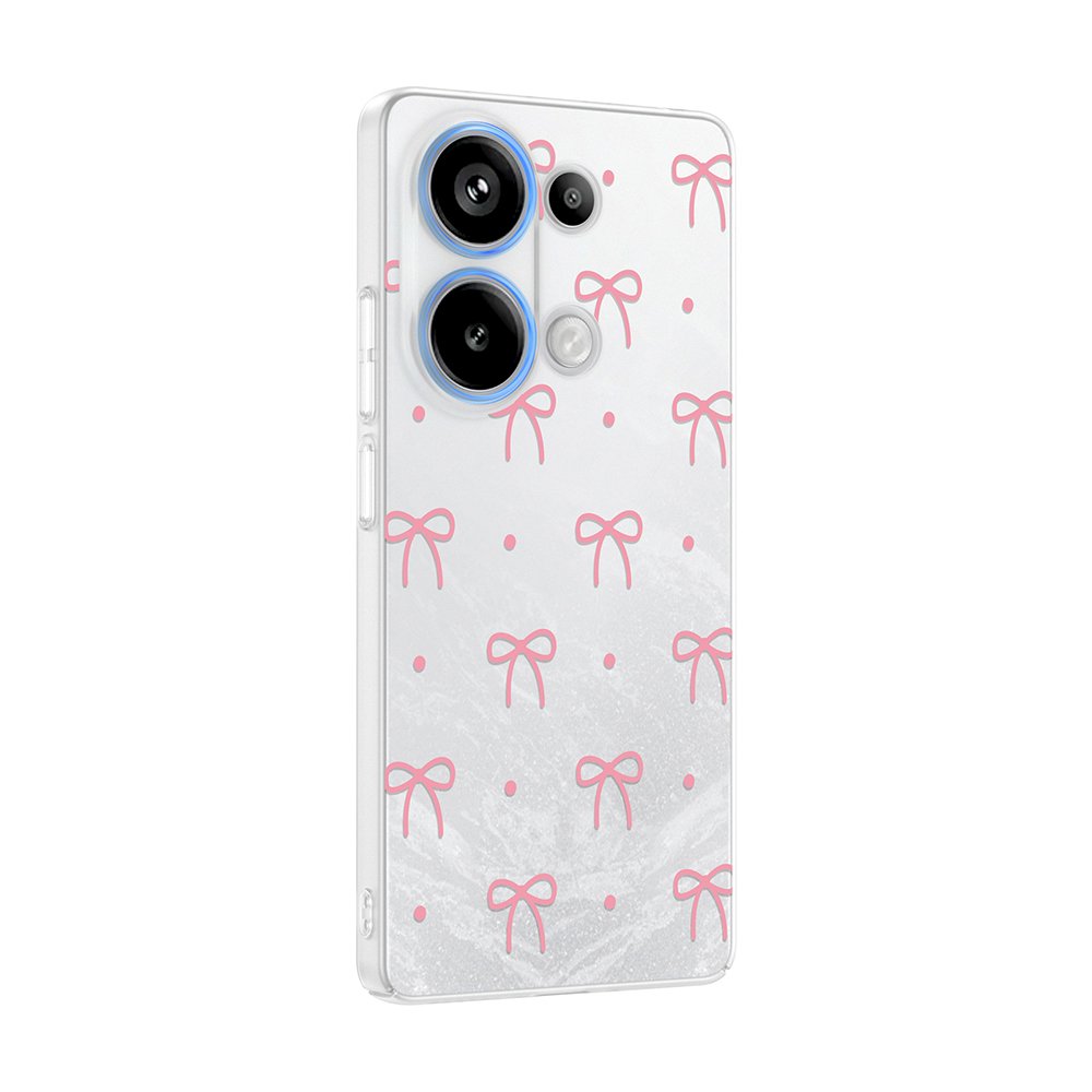 Xiaomi Redmi Note 13 Pro 4G Kılıf Kamera Korumalı Canlı Lüx Desenli Klip Sert Kapak