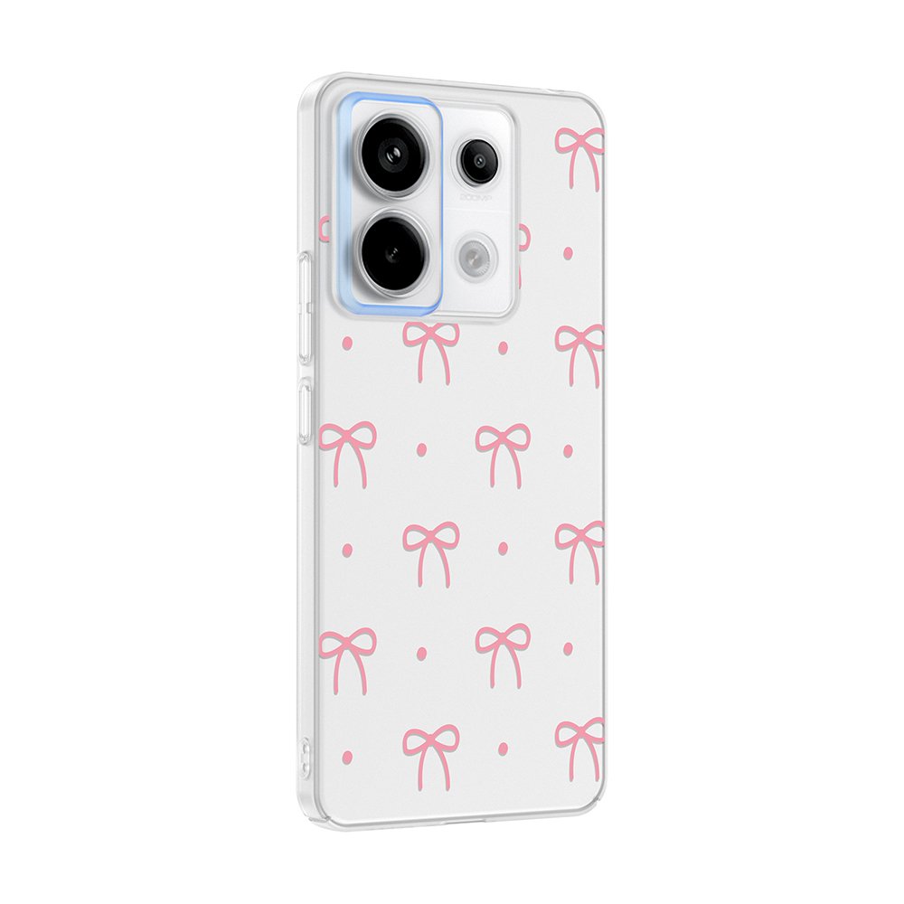 Xiaomi Redmi Note 13 Pro 5G Kılıf Kamera Korumalı Canlı Lüx Desenli Klip Sert Kapak