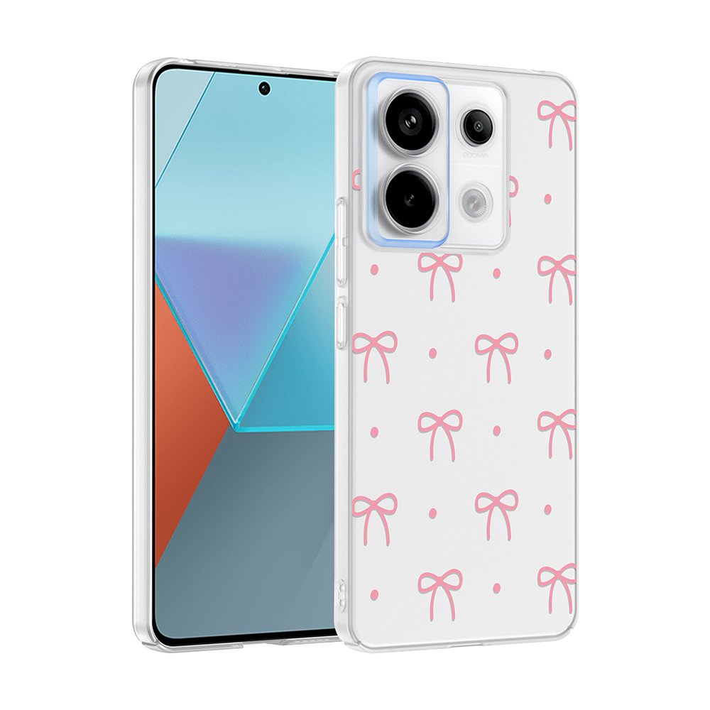 Xiaomi Redmi Note 13 Pro 5G Kılıf Kamera Korumalı Canlı Lüx Desenli Klip Sert Kapak