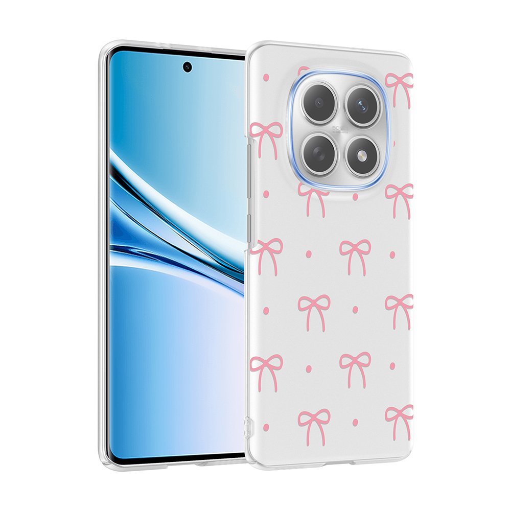 Xiaomi Redmi Note 14 Pro 4G Kılıf Kamera Korumalı Canlı Lüx Desenli Klip Sert Kapak