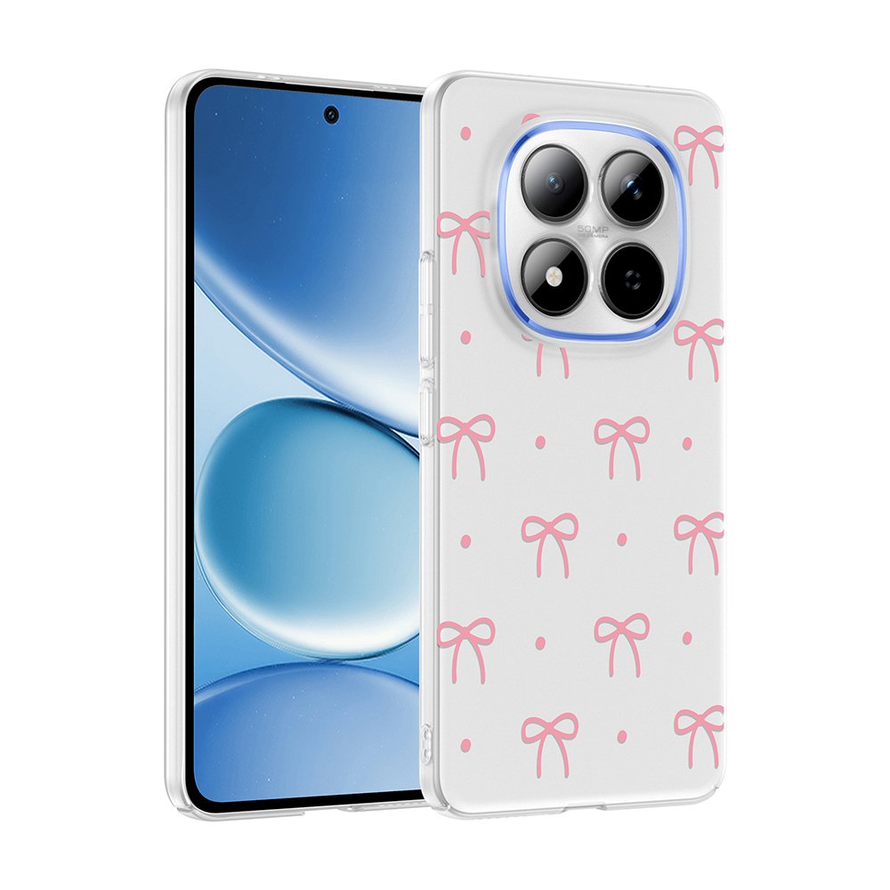 Xiaomi Redmi Note 15 Pro 4G Kılıf Kamera Korumalı Canlı Lüx Desenli Klip Sert Kapak